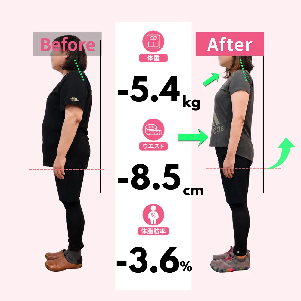 50代女性のお客様のビフォーアフター（モデル）