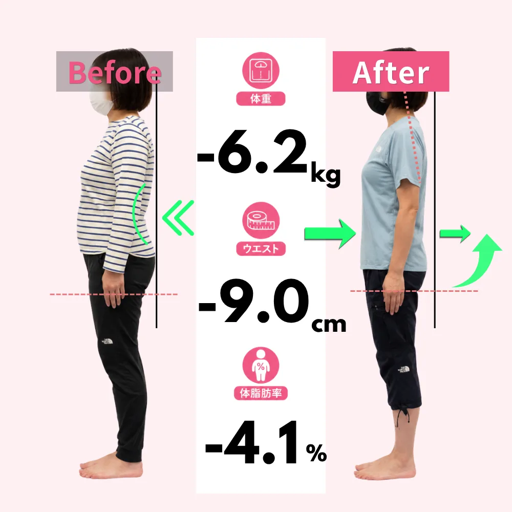 30代女性のお客様のビフォーアフター（モデル）