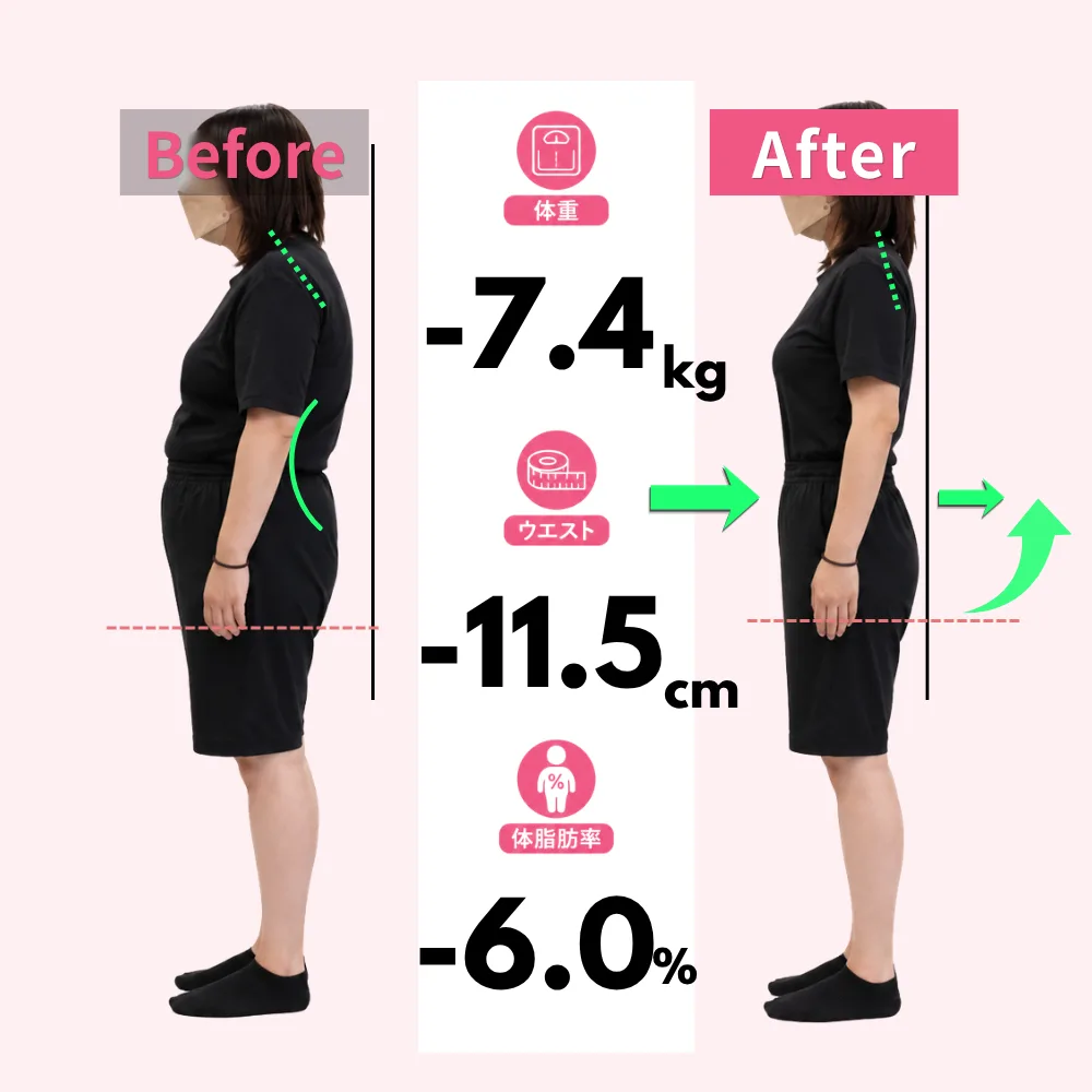 40代女性のお客様のビフォーアフター（モデル）